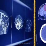 پیشبینی آینده رادیولوژیست ها باوجود هوش مصنوعی
