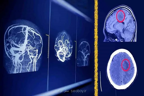 پیشبینی آینده رادیولوژیست ها باوجود هوش مصنوعی